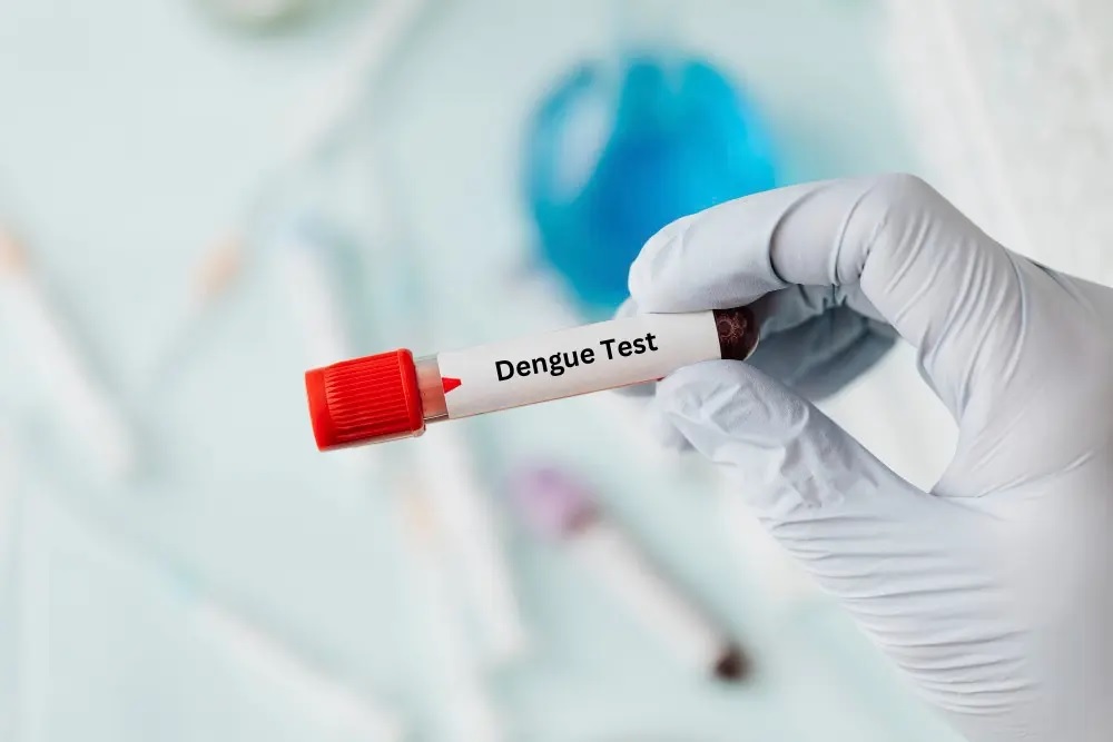 Forms of Dengue Assessments: Which One is Proper for You? – Your Clinical Forestall